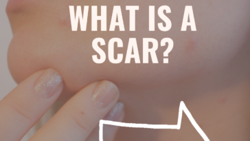 What is a Scar
