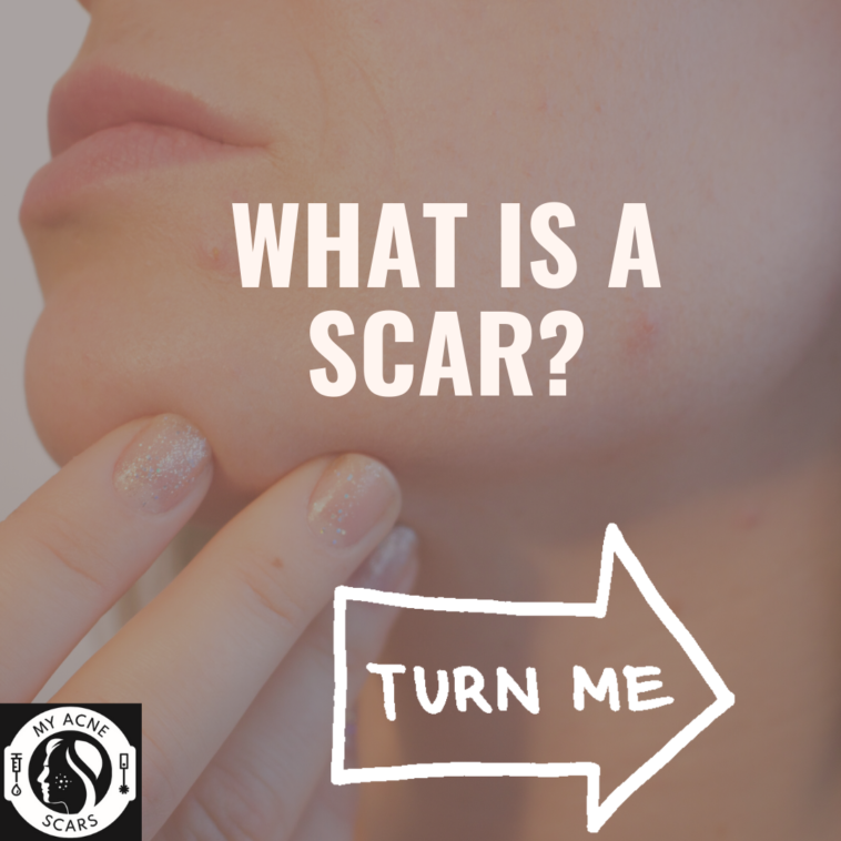 What is a Scar