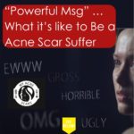 What It's Like to Have Acne Scars / Acne - Powerful Message 7 1 1