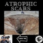 Atrophic Scar: Overview 7 1 5