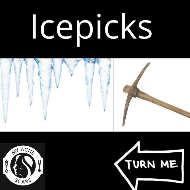 1 1
