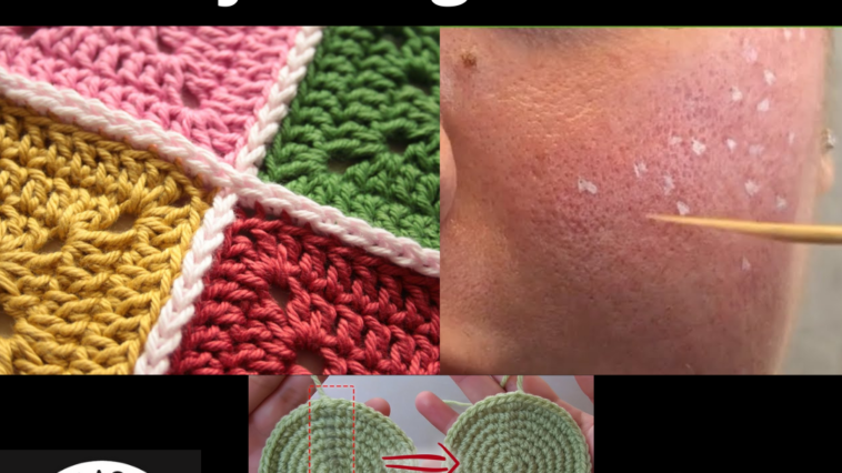 Cross Adjoining Scars