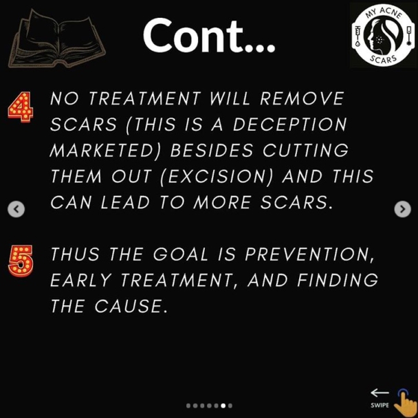 What is an Acne Scar My Acne Scars