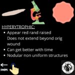 Hypertrophic Vs Keloid Scarring 5 4 4